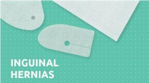 Inguinal hernias